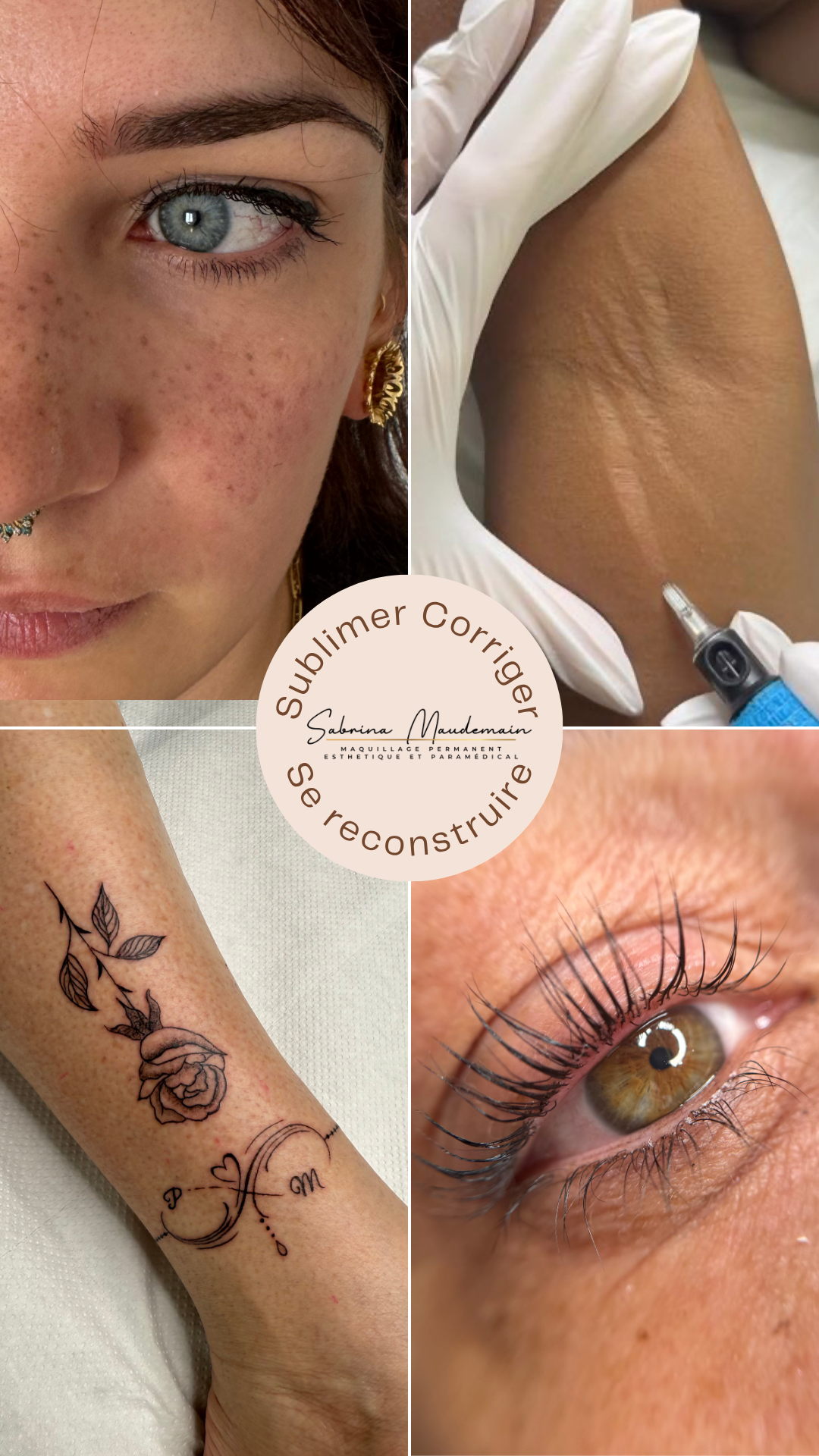 Sabrina Maudemain pigmentation post-cancer en Vendée